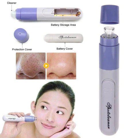 New 1Pc Electric Facial Pore Cleanser - Fiveas Store